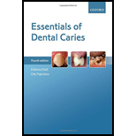 Essentials of Dental Caries