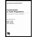 Fundamentals of Tooth Preparations : For Cast Metal and Porcelain Restorations