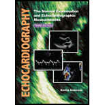 Echocardiography