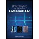 Understanding Intracardiac EGMs and ECGs