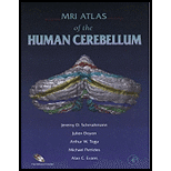 MRI Atlas of Human Cerebellum