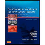 Prosthodontic Treatment for Edentulous Patients