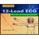 12-lead Ecg Art Of Interpretation