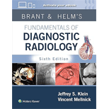 Brant and Helm's Fundamentals of Diagnostic Radiology - With Access